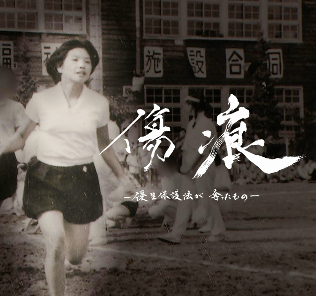 「傷痕-優生保護法が奪ったもの-」